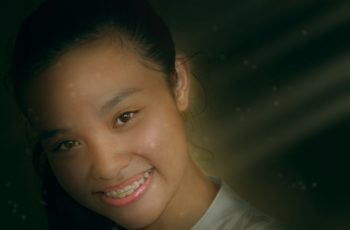 dental braces
